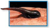 A brown leech is feeding on the human blood.