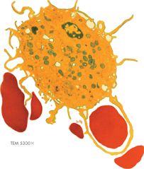The illustration demonstrating endocytosis of a damaged R.B.C by a W.B.C. by engulfing. A white blood cell is engulfing a damaged red blood cell by phagocytosis, a form of endocytosis with help of extensions in its cell membrane.