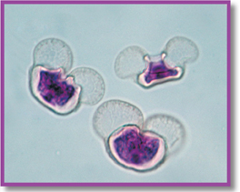 A micrograph of a specialized plant cells: Pollen of pine tree.