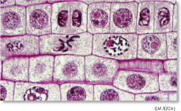 A slide of a stained onion root tip viewed under a light microscope showing cells with different stages of cell division.