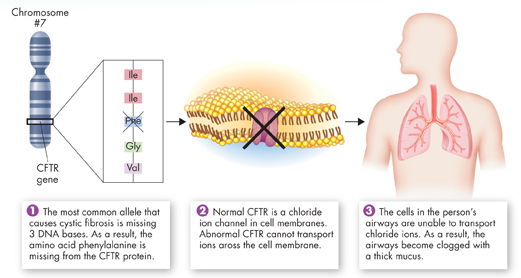An illustration showing the linkage between Cystic Fibrosis (CF) and Mutation.
