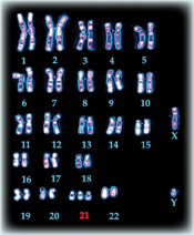 A human karyotype, showing the arrangement of 22 chromosomes that are present in human cell, in order of decreasing size. Number 21 is marked in red. The X and Y chromosomes are shown separately.