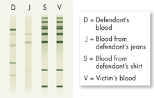 The diagram shows four DNA bands D, J, S and V from four different blood samples.