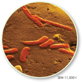 A microscopic image of fossilized bacteria.