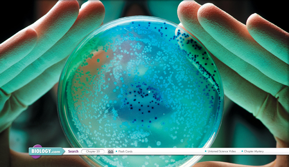 A pair of hands hold a Petri dish containing colonies of E. coli bacteria.