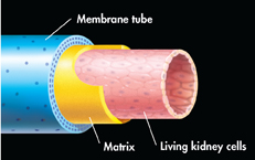 The image illustrates parts in bioartificial kidney. Three concentric cylinders are shown: 
 Outer cylinder marked as 'Membrane tube' is blue in color. 
 Middle cylinder marked as 'Matrix' is yellow in color.
 Inner cylinder marked as ' Living kidney cells' is pink in color.