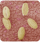 A photograph showing pollen grains trapped on the walls of trachea.