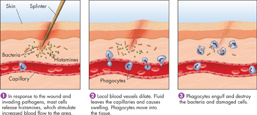 A set of pictures indicating the inflammatory response.