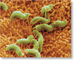 A micrograph of Helicobacter pylori.