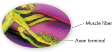 A picture of a neuromuscular junction.
 The parts labeled in the picture are:
 1. Muscle fiber
 2. Axon terminal