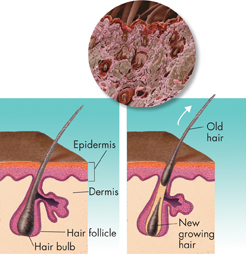 An illustration of growth of hair in the skin.