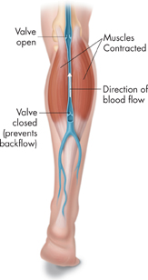The illustration showing the flow of blood through the veins in the leg. The following parts are labeled.
 1. Valve open
 2. Muscles contracted
 3. Valve closed (prevents backflow)
 4. Direction of blood flow is indicated by an upward arrow