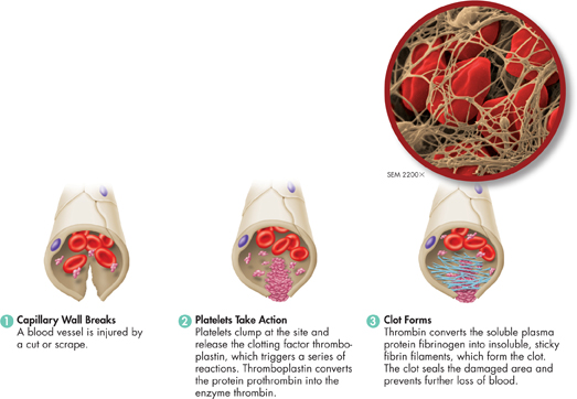 An illustration depicting the process of formation of blood clots.