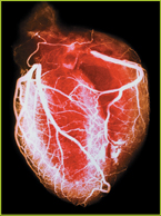 A computed tomography scan of the heart.