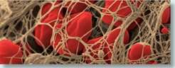 A micrograph of a clot indicating fibrin net preventing blood loss.
