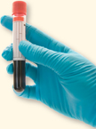 A photograph of a gloved hand holding a test tube half-filled with blood.