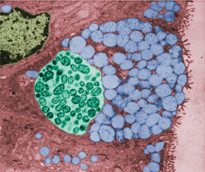 A micrograph showing Chlamydia infection.