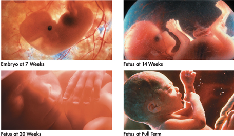 Four photographs indicating the development of a child:
 Embryo at 7 weeks,
 Fetus at 14 weeks.
 Fetus at 20 weeks, and
 Fetus at full term.