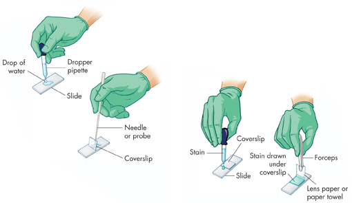 Illustration shows the procedure to prepare for Wet-Mount slide and staining techniques.