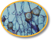 A micrograph shows spores of Synchytrium endobioticum in potato cells