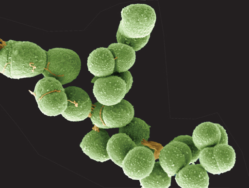 Green colored halophilic archaea.