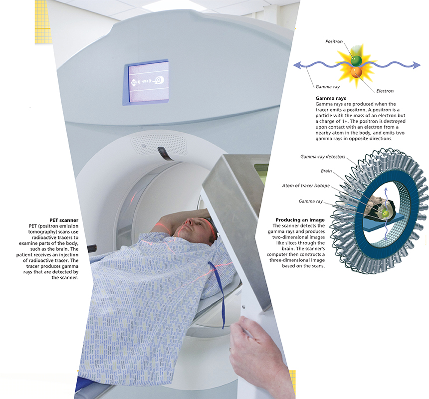 A patient lying on a table while entering a tunnel-like machine for an imaging diagnostic test.