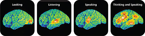 Four scans of the human brain using gamma rays.
