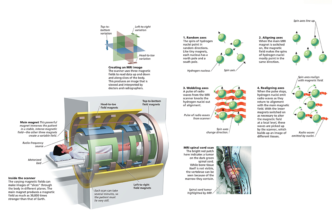 A diagram shows the structure of an MRI machine. The varying magnetic fields can make images of “slices” through the body in different planes. The main magnet produces a magnetic field as much as 30,000 times stronger than that of Earth.